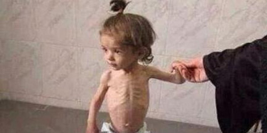   به‌ وێنه‌.. منداڵانی مه‌زایا له‌ برسان ده‌مرن